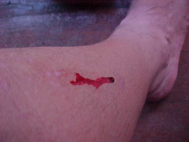 Leach bite! : Looks like I needed to purchase some "Stoking pachats".  Literally "leach stockings" in Bahasa, they are special canvas gaitors used to prevent the blood suckers from getting you. (Malaysia, The Travel Addicts)